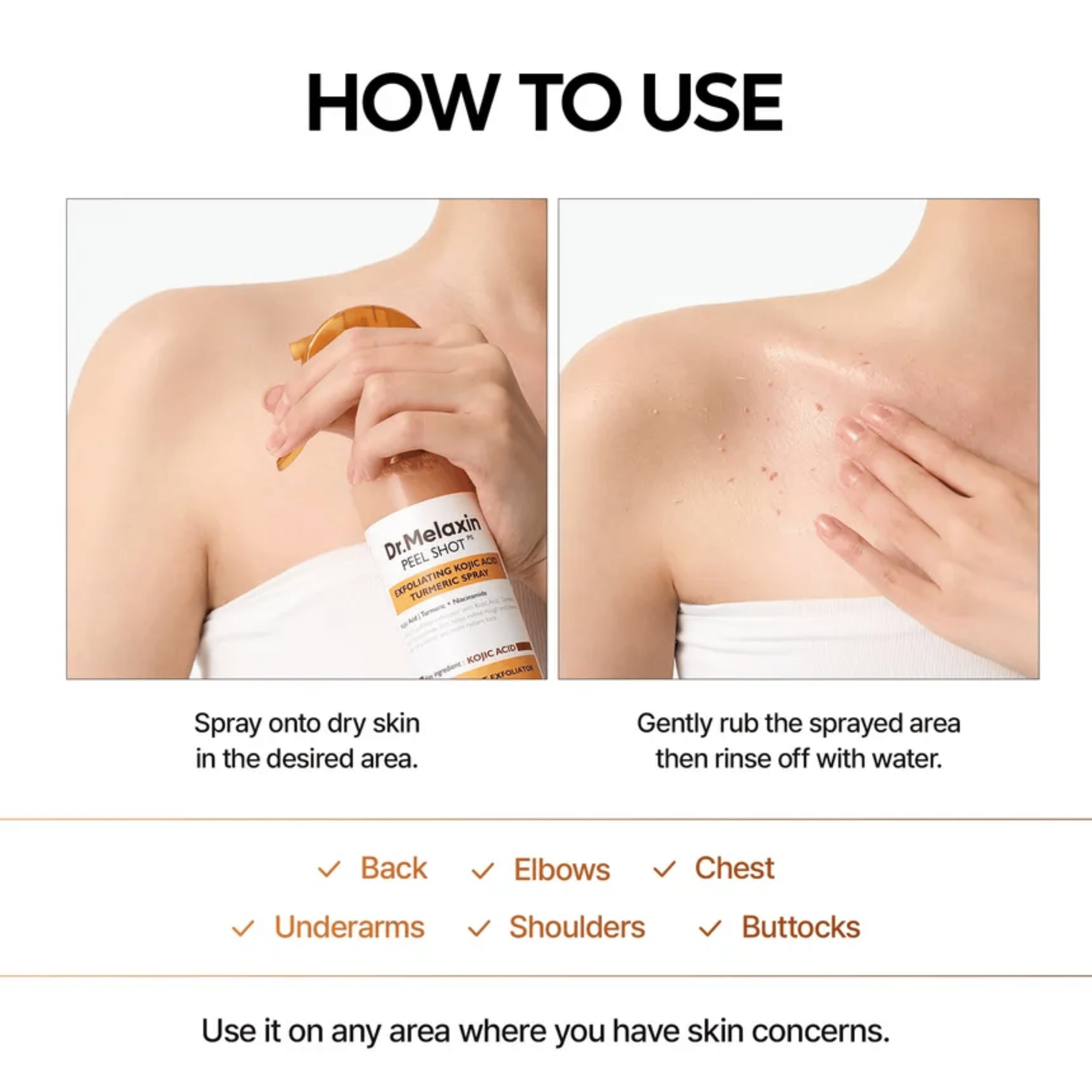 Dr.Melaxin Peel Shot Exfoliating Kojic Acid Turmeric Spray 200ml - cosmadic