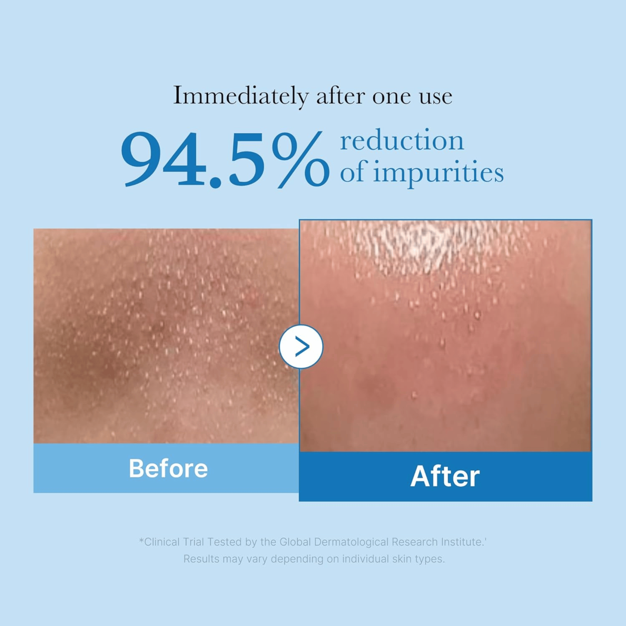 Medicube Zero Pore Blackhead Deep Cleansing Oil 205ml - cosmadic