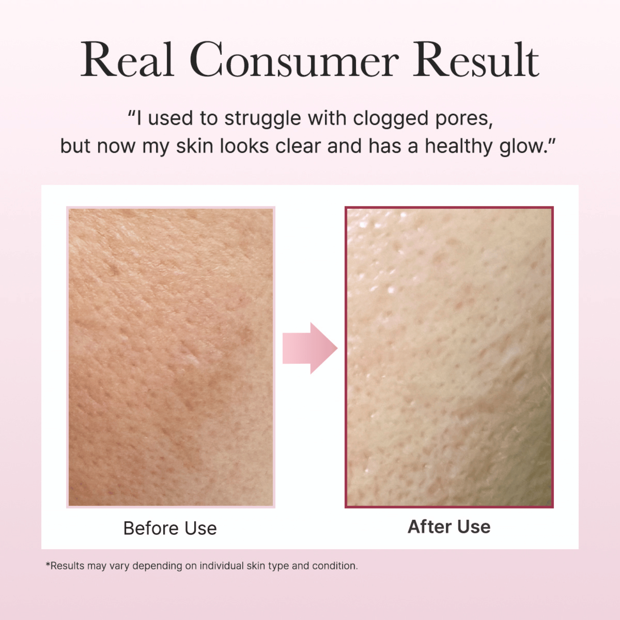 Arencia Fresh Rosehip Rice Mochi Cleanser - cosmadic
