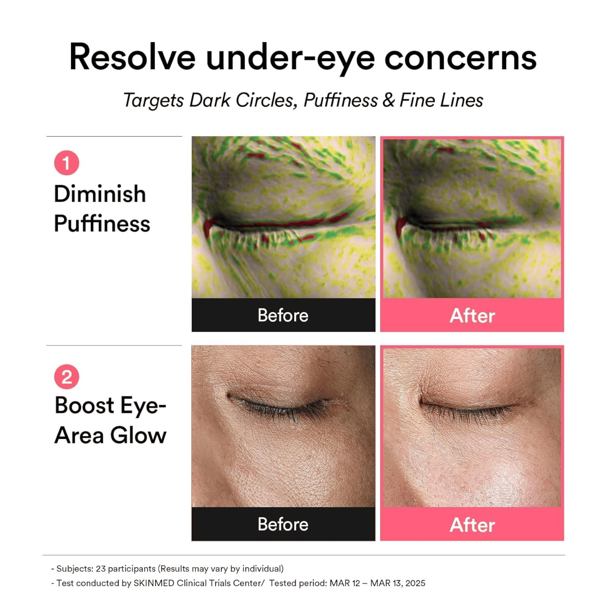 Abib PDRN Retinal Eye Patch Glow Jelly 60 Stk - cosmadic