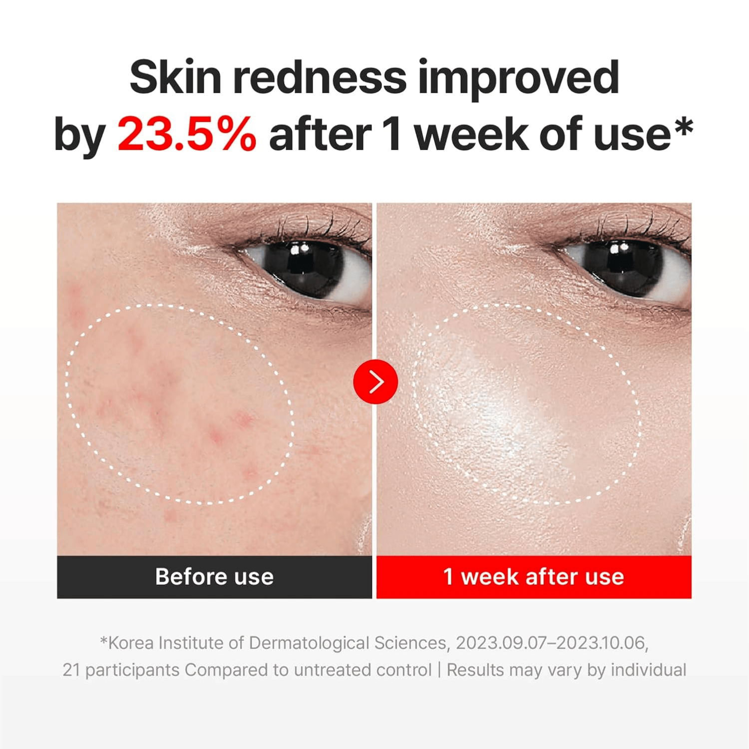 Centellian24 Madeca Cream Time Reverse 50ml - cosmadic