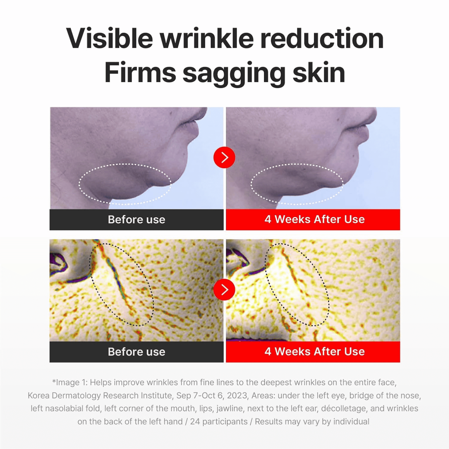 Centellian24 Madeca Cream Time Reverse 50ml - cosmadic