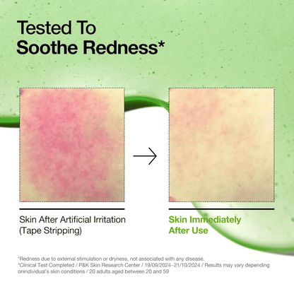 Anua Azelaic Acid 10+ Hyaluron Redness Soothing Serum 30ml - cosmadic