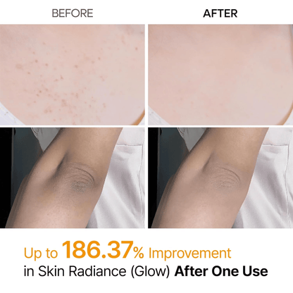 Dr.Melaxin Peel Shot Exfoliating Kojic Acid Turmeric Spray 200ml - cosmadic