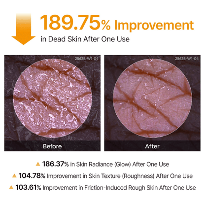 Dr.Melaxin Peel Shot Exfoliating Kojic Acid Turmeric Spray 200ml - cosmadic