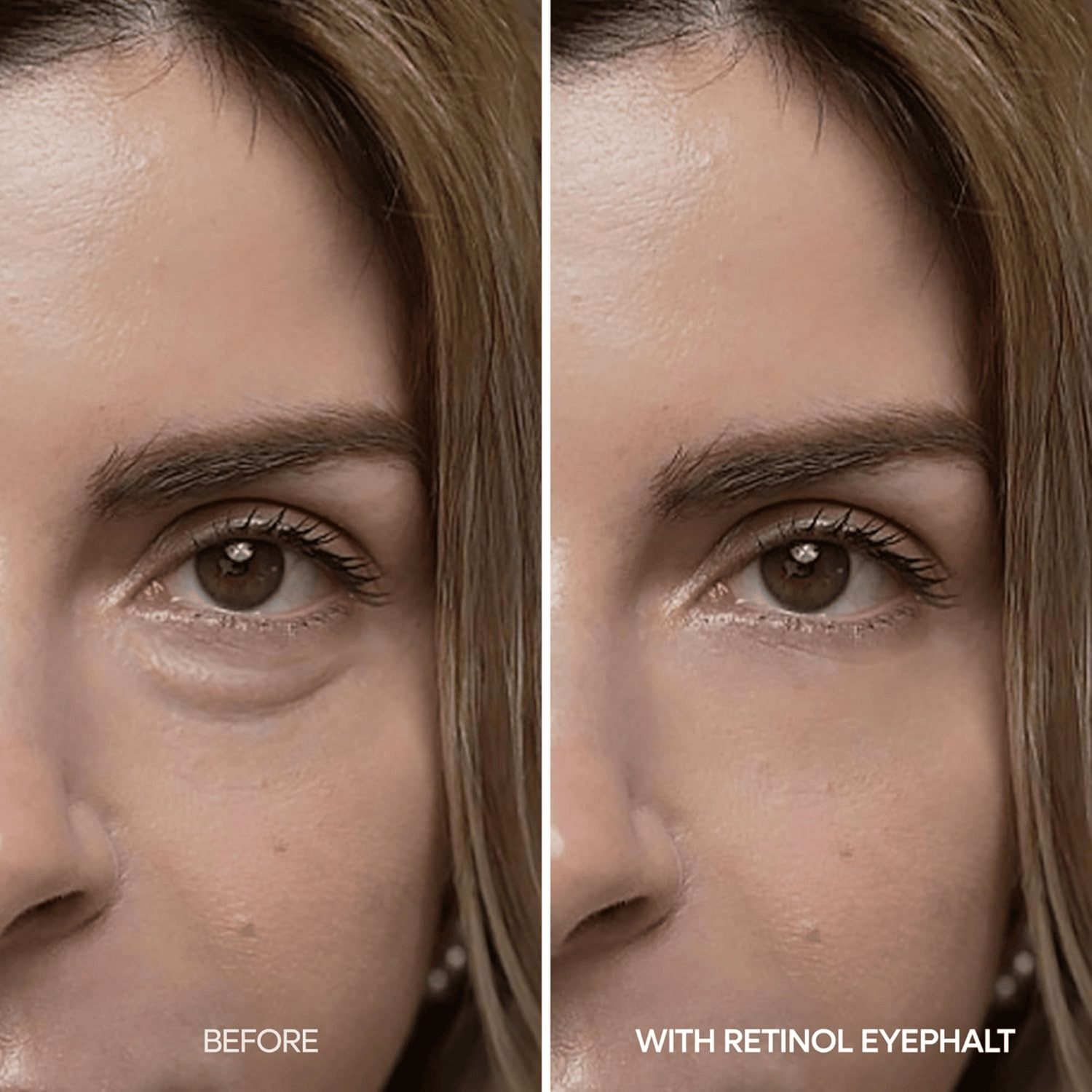 Dr.Melaxin Eyephalt Retinol Eyebag Cream - cosmadic