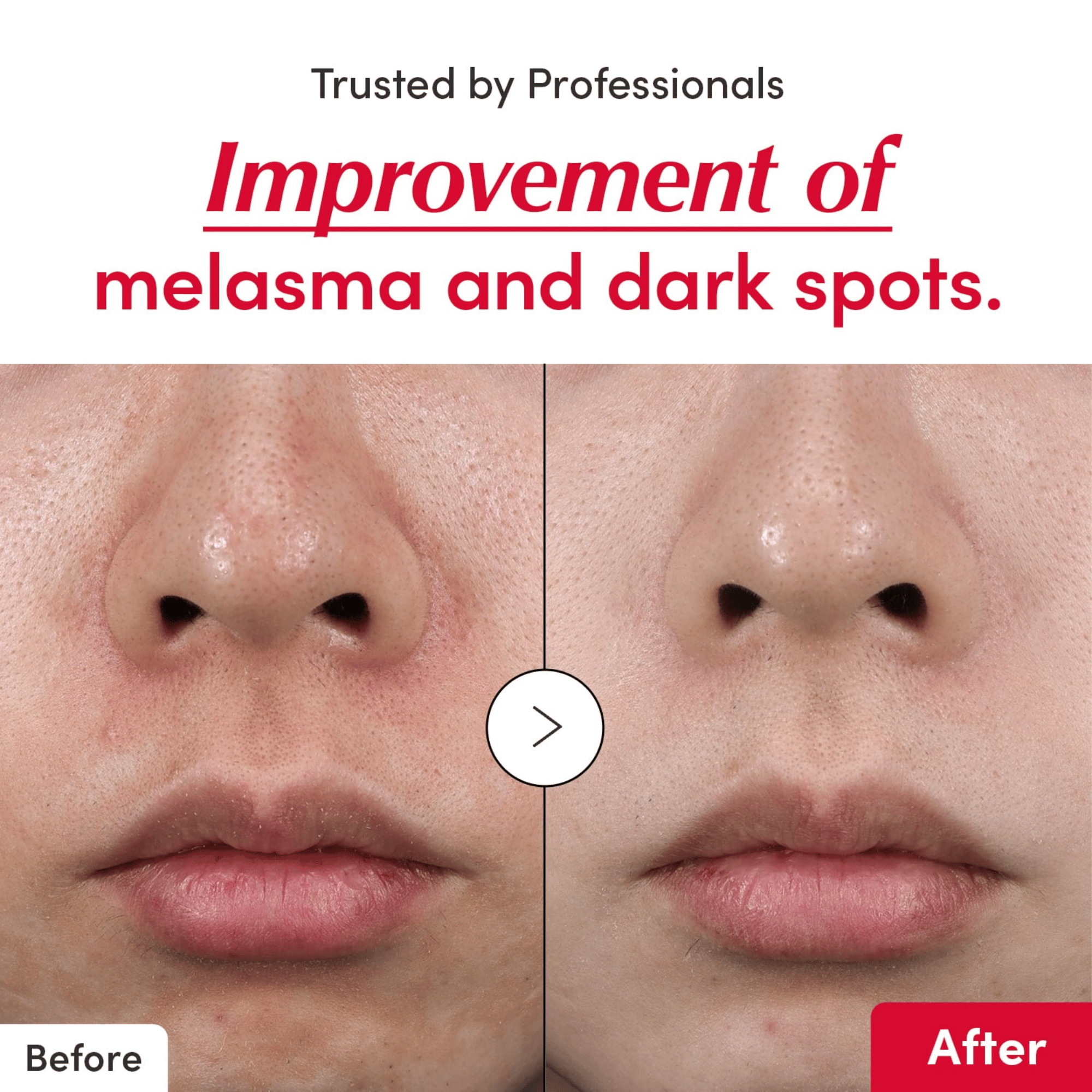 EQQUALBERRY Vitamin Illuminating Serum 30ml - cosmadic