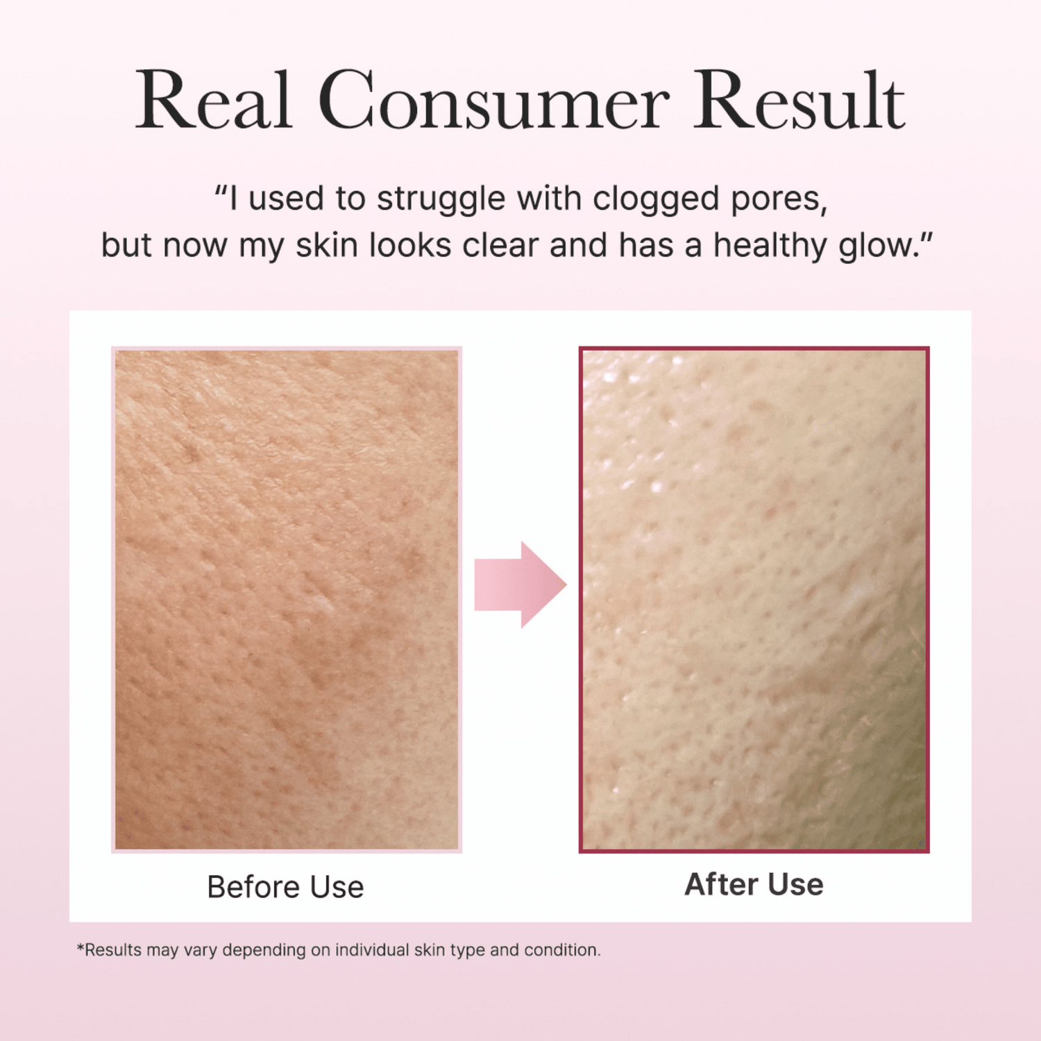 Arencia Fresh Rosehip Rice Mochi Cleanser - cosmadic