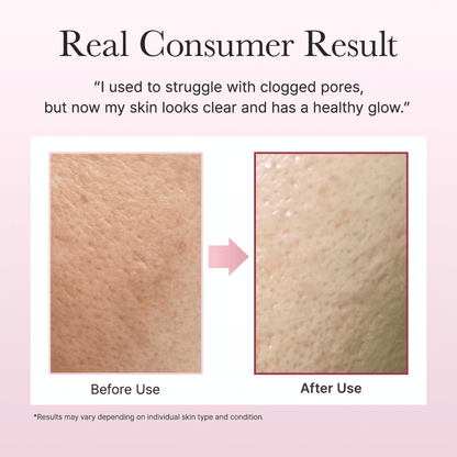 Arencia Fresh Rosehip Rice Mochi Cleanser - cosmadic