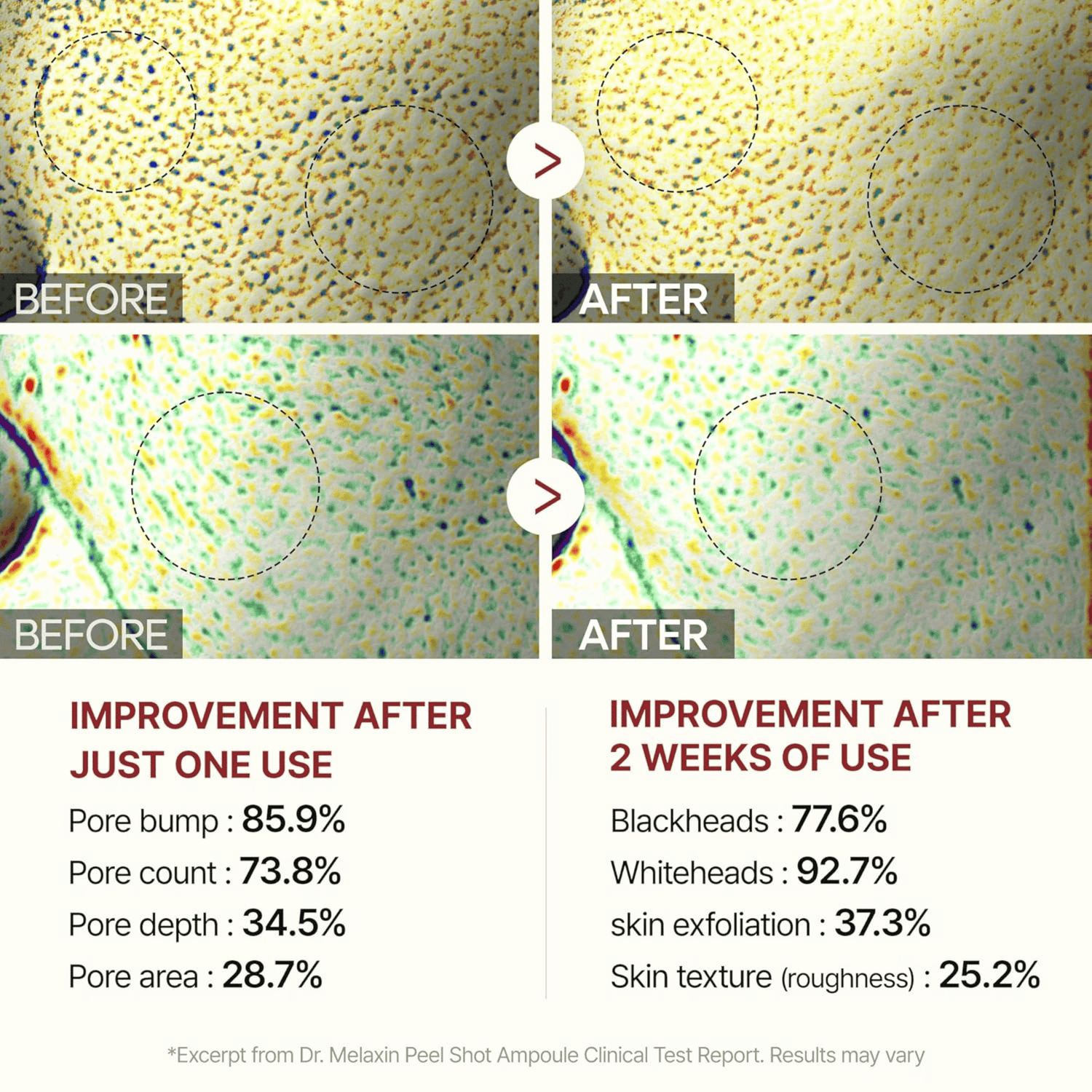 Dr.Melaxin Peel Shot Exfoliating Black Rice Ampoule 80ml - cosmadic