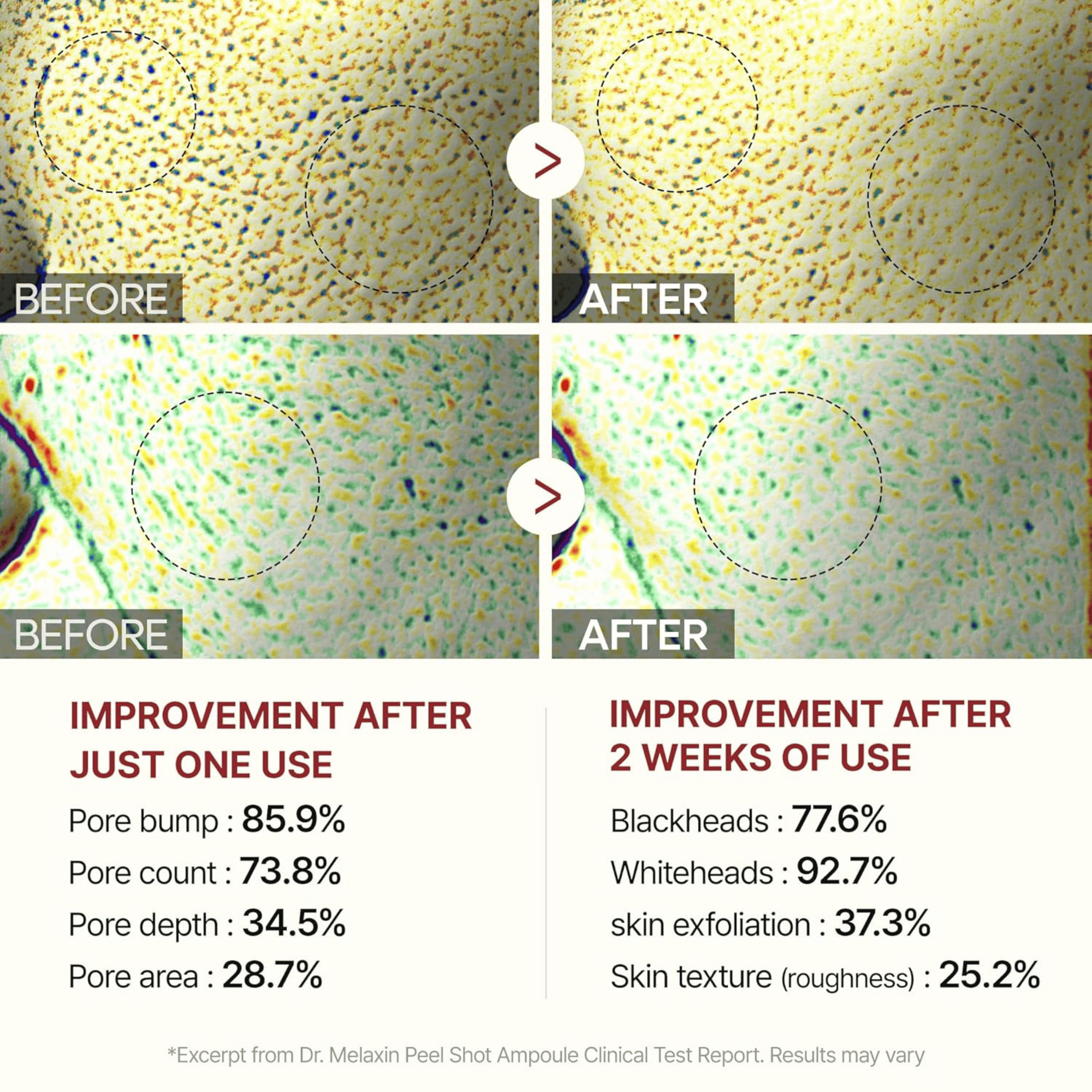 Dr.Melaxin Peel Shot Exfoliating Black Rice Ampoule 80ml - cosmadic