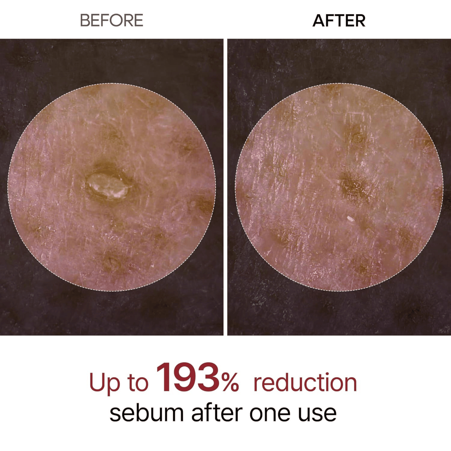 Dr.Melaxin Peel Shot Exfoliating Black Rice Ampoule 80ml - cosmadic