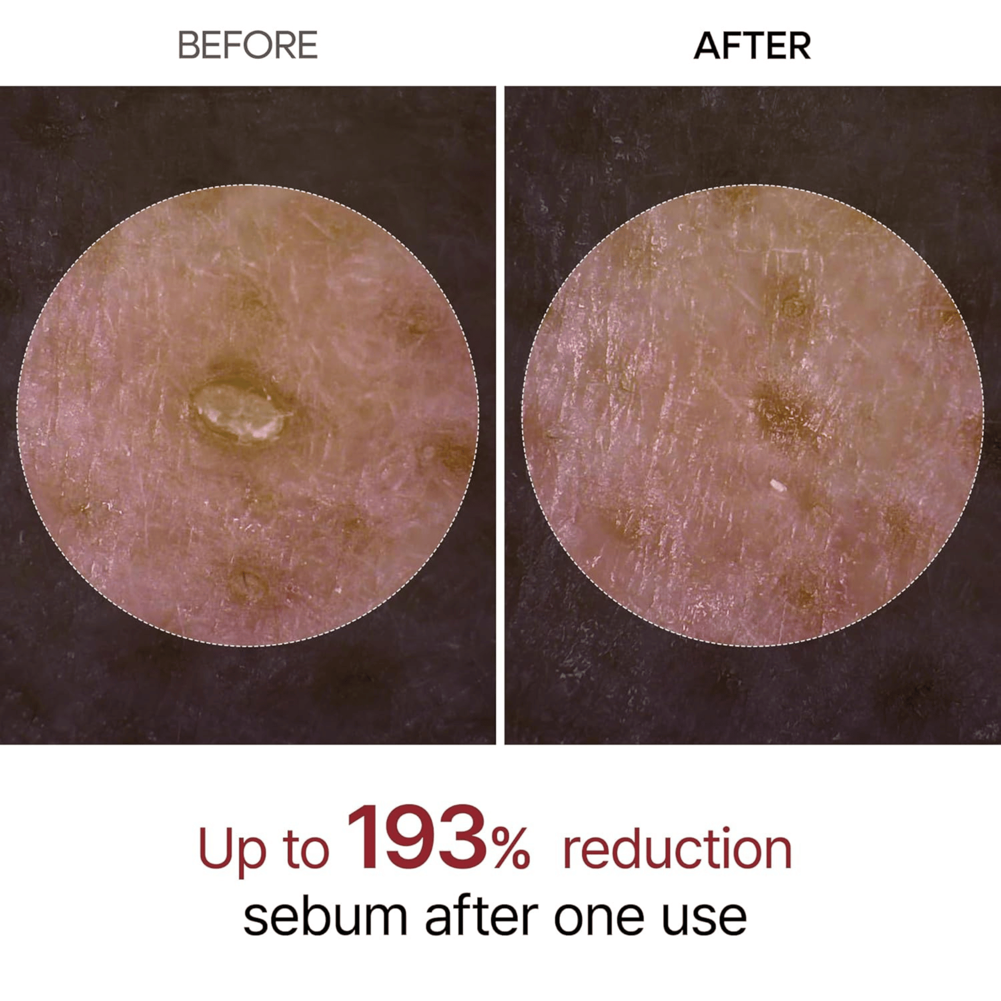 Dr.Melaxin Peel Shot Exfoliating Black Rice Ampoule 80ml - cosmadic