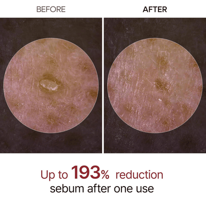 Dr.Melaxin Peel Shot Exfoliating Black Rice Ampoule 80ml - cosmadic