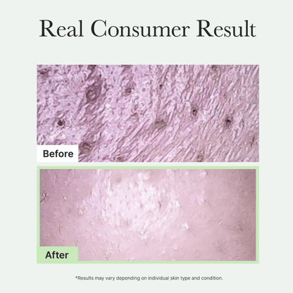 Arencia Fresh Green Rice Mochi Cleanser - cosmadic