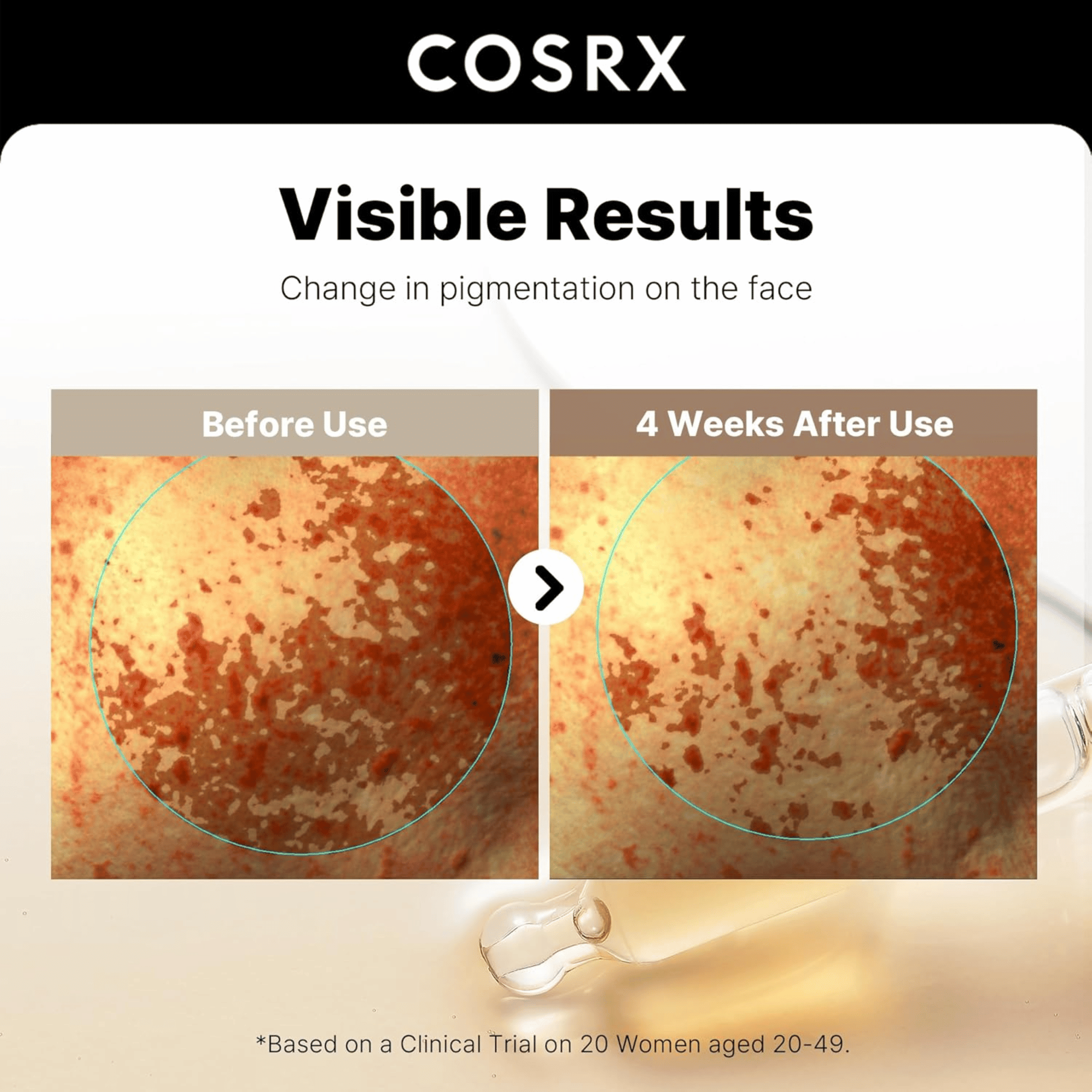 COSRX The Alpha-Arbutin 2 Discoloration Care Serum 50ml - cosmadic