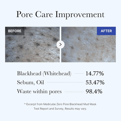 Medicube Zero Pore Blackhead Mud Mask 100g - cosmadic