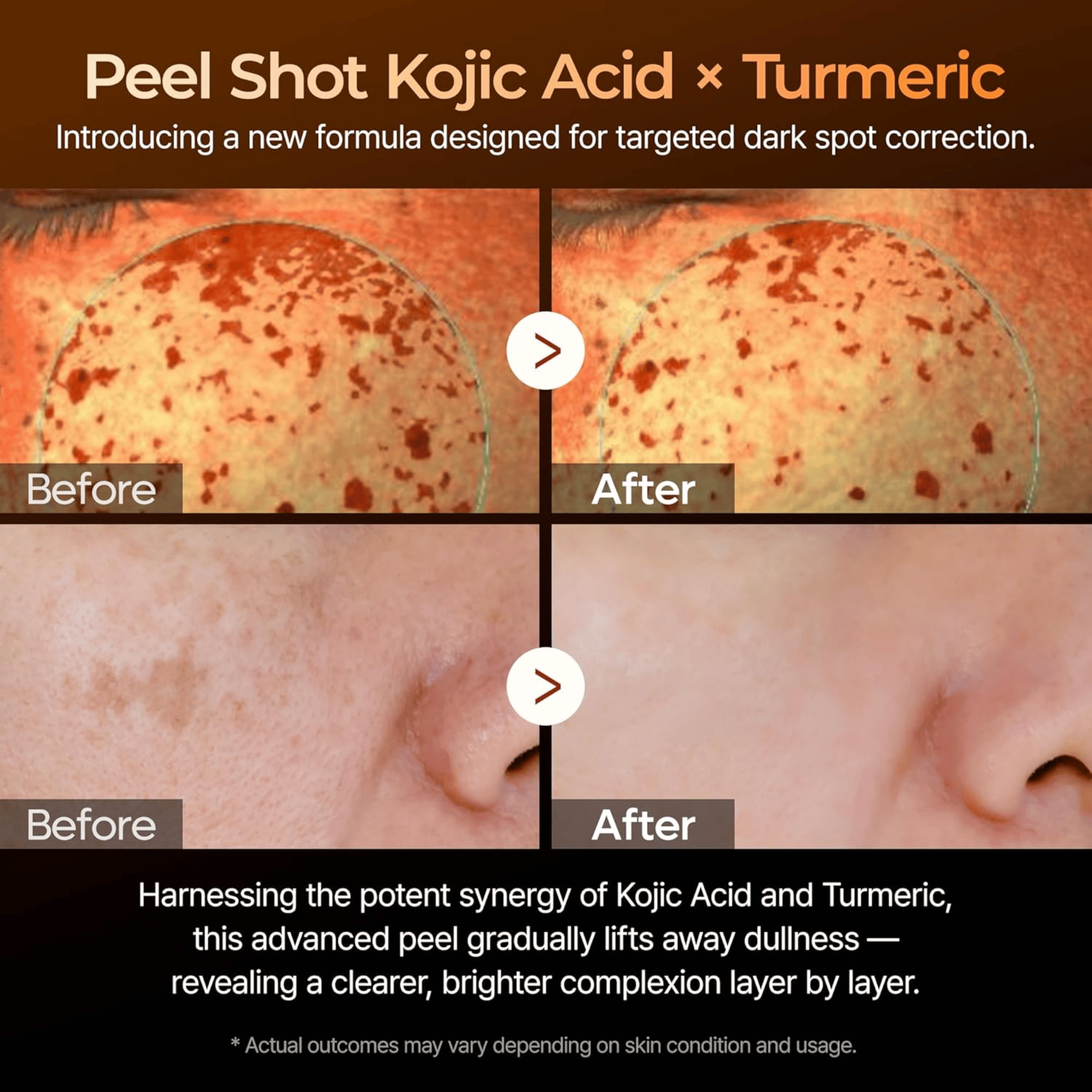 Dr.Melaxin Peel Shot Exfoliating Kojic Acid Turmeric Serum 80ml - cosmadic